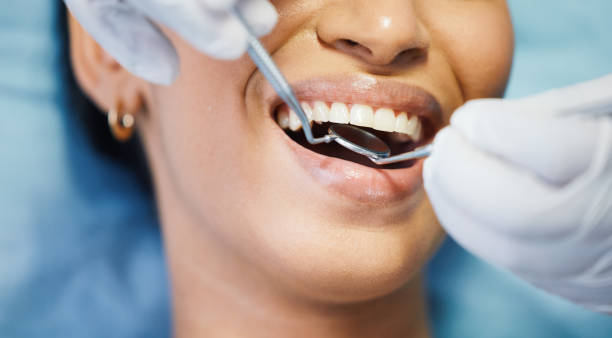 Best Knocked-Out Tooth Emergency  in Celina, OH