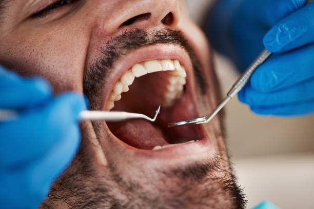 Best Urgent Tooth Repair  in Celina, OH