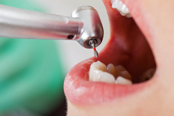 Best Emergency Tooth Extraction  in Celina, OH